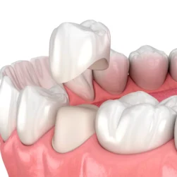 delightful-restorative-dentistry-scaled