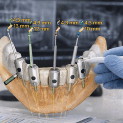 Prosthodontic Planning 2